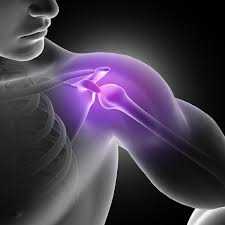 Image result for Rotator cuff tear