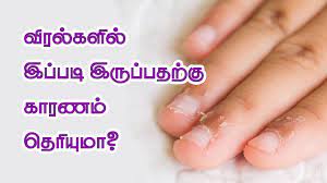 What Your Nails Say About Your Health Tamil Health Tips Health Health Tips You Nailed It