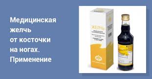 как лечить косточку на ноге в домашних условиях отзывы Medicinskaya Zhelch Primenenie Pri Kostochkah Na Nogah Otzyvy