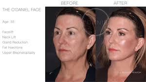 Louisville Plastic Surgery Center