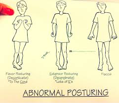 Pin On Nursing