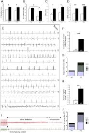 Sebab itu jika anda mencari borang perekodan pbs tahun 4, 5. Spred2 Deficiency Elicits Cardiac Arrhythmias And Premature Death Via Impaired Autophagy Journal Of Molecular And Cellular Cardiology