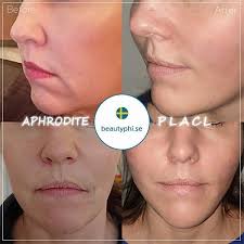 좋아요 18개, 댓글 0개