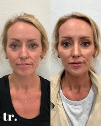 Happy Father's Day— but an extra Happy Father's Day to all  @thetreatmentroomokc dad(s) that have loved us from the very beginning—  thank you for encouraging, believing and loving us 🤍 To the