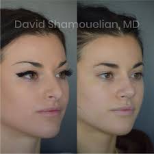 TOP 10 BEST Dr David Bush near West Hills, Los Angeles, CA