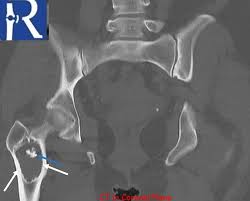 Image result for Incidental Imaging Finding
