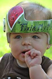 Pin By Leigh Gibson On Cranial Bands Helmets Baby Helmet Doc Band Baby Helmet Design