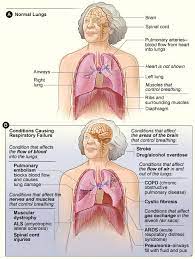 Figure A Shows The Location Of The Lungs Airways Diaphragm Rib Cage Pulmonary Arteries Brain And Spinal Co Respiratory Care Medical Education Respiratory