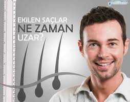 Ekilen Saclar Ne Zaman Cikar Ve Uzar Yetkin Bayer