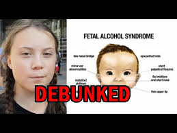 Whether it's windows, mac, ios or android, you will be able to download the images using download button. Does Greta Thunberg Have Fetal Alcohol Syndrome Youtube