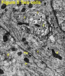 Jun 01, 2021 · the molecular regulation of cancer metastasis is not fully understood. Electron Micrographs