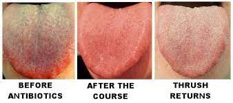 Pin On Treating