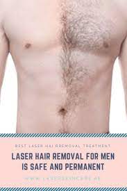laser hair removal for men gesicht haarentfernung gesicht schnurrbart