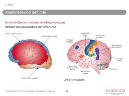 Arterielle versorgung des kleinhirns und des hirnstamms ; Diagnose Und Therapie Des Hirnschlags Ppt Herunterladen