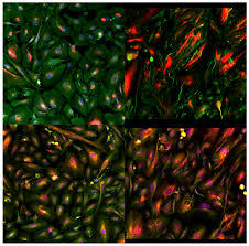 Image result for Eye Rest Green 1972 Hussmann