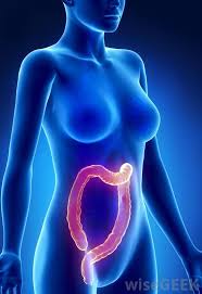 According to the centers for colon cancer is a growth in the colon that usually arises from a polyp. What Are The Symptoms Of Advanced Colon Cancer With Pictures