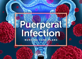 The initial nursing action in performing this assessment is which of the following? 4 Puerperal Infection Nursing Care Plans Nurseslabs