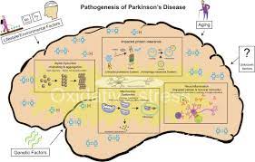 Parkinson S Disease Etiopathogenesis And Treatment Journal Of Neurology Neurosurgery Psychiatry