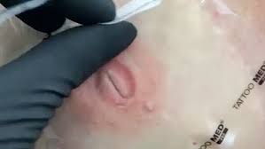 I've heard that the ink gets absorbed into the body. Artists S Nipple Tattoos For Cancer Survivors Deleted On Facebook Metro News