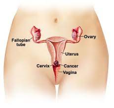 Jan schaefer, chief medical officer at medigo, outlines some of the early signs of cervical cancer in more detail Cervical Cancer In Girls And Young Women