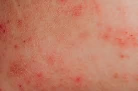 They may be small or tiny (pinpoint) dots, or large blotches, itchy or not. Skin Conditions That Make Your Feet Itch