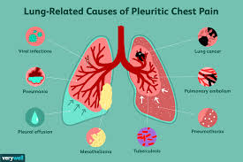 Gastroesophageal reflux disease (gerd), caused by stomach acid splashing up into the esophagus, can cause a burning. Pain With Deep Breathing Symptoms Causes And Diagnosis