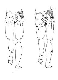 Do You Wiggle When You Walk Gillispie Partners In Wellness Hip Muscles Gluteus Medius Body Health