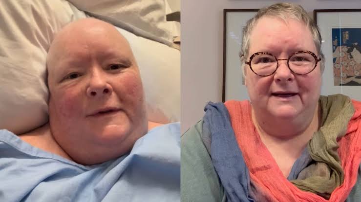 Magda Szubanski in remission from aggressive Mantle Cell lymphoma | The Australian