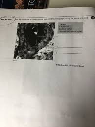 The outer part of a long bone is made of compact bone. Structures Indicated In A The Unsectioned Long Bone Fifth Metatarsal And B The Partially Long Bone Homeworklib
