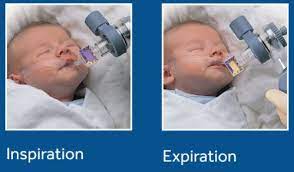 page 2 covidien nellcor easycap ii manual. Covidien Pedicap Detector Pediatric Easy Cap Co2 Each Cia Medical