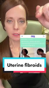 Thanks @Erica Chidi! If you arent getting the care you need seek out a MIGS  surgeon or fibroid specialist! #fibroids #fibroidtumors #gyntok  #gynecologist