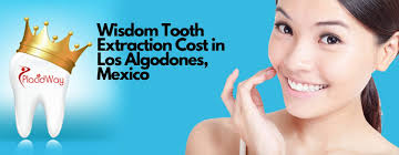 And even when a lot of dental offices offers you packages deals to remove all your wisdom teeth at once, the price can go from $125 to usd 3,000. How Much Would I Pay For Wisdom Tooth Extraction In Los Algodones Mexico Mexico Border Dentist