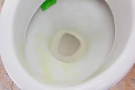 How To Treat Toilet Bowl Stains Hunker Toilet Bowl Stains Toilet Bowls Toilet Stains