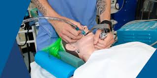 Image result for Active Labor Anesthesia