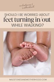 Image result for Out-toeing
