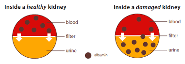 Explaining Your Kidney Test Results A Tear Off Pad For Clinical Use Niddk