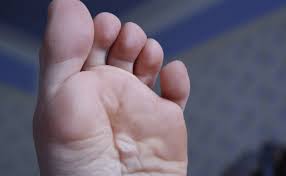 Check spelling or type a new query. Comment Soigner Une Ampoule 5 Astuces Simples Et Rapides