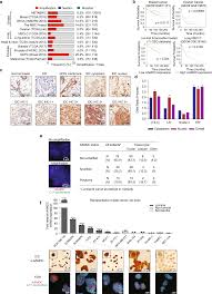 Santa cruz shredder grinder presented by emily ann plizak. The Oncogene Aamdc Links Pi3k Akt Mtor Signaling With Metabolic Reprograming In Estrogen Receptor Positive Breast Cancer Nature Communications