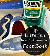You can feel it if you rub your feet against each other, but do have patience and soak the feet for 20 minutes and all the dry. Diy Listerine Dead Skin Remover Foot Soak Stockpiling Moms