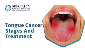 Image result for cancer tongue symptoms)