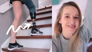 iWalk Modification for Amputees! Let's use some power tools...