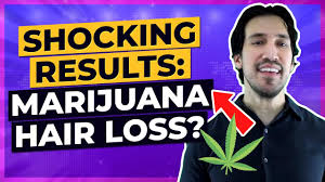 I started smoking when i was 15 and by 16 i was a daily smoker. Fact Can Smoking Marijuana Cause Hair Loss Cannabis Thc Oil Natural Regrowth After Quitting Pot Youtube