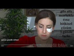 Goz Alti Morluklarina Bitkisel Cozum 3 Gunde Farki Gorun Youtube Gozler Youtube Gunaydin