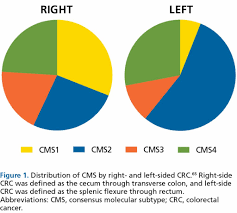 Doctors screen for this type of cancer by looking for polyps in the. Right Versus Left Colon Cancer Biology Integrating The Consensus Molecular Subtypes In Journal Of The National Comprehensive Cancer Network Volume 15 Issue 3 2017