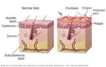 Image result