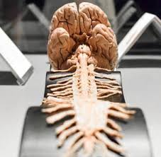 The major column of nerve tissue that is connected to the brain and lies within the vertebral canal and from which the spinal nerves emerge. Mozg I Rdzen Kregowy Czlowieka