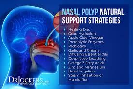Maybe you would like to learn more about one of these? Nasal Polyps Symptoms Causes And Natural Support Strategies