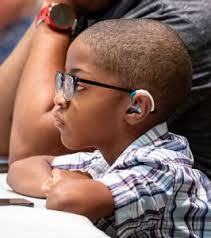 Hearing Aids/Cochlear Implants