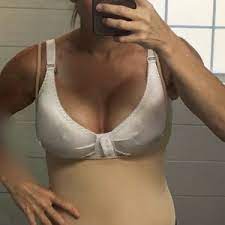 Check spelling or type a new query. Do Patients Who Get Implants With A Lift Drop Later Than Patients With Just Implants What Is An Average Timeline Photos