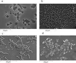 Incubation time was set to be 2 h since with incubation time less than 2 h, we would get lower agglutination responses. Plos One Biofilm Forming Abilities Of Listeria Monocytogenes Serotypes Isolated From Different Sources